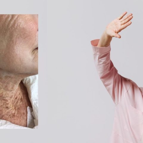 cuello piel envejecida