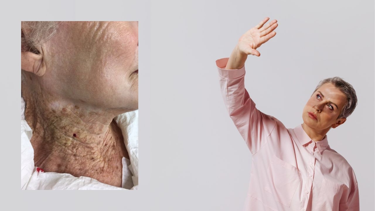 cuello piel envejecida