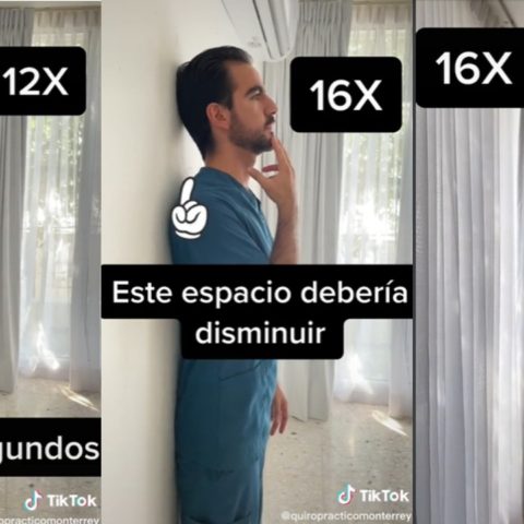 Ejercicios para quitar la joroba