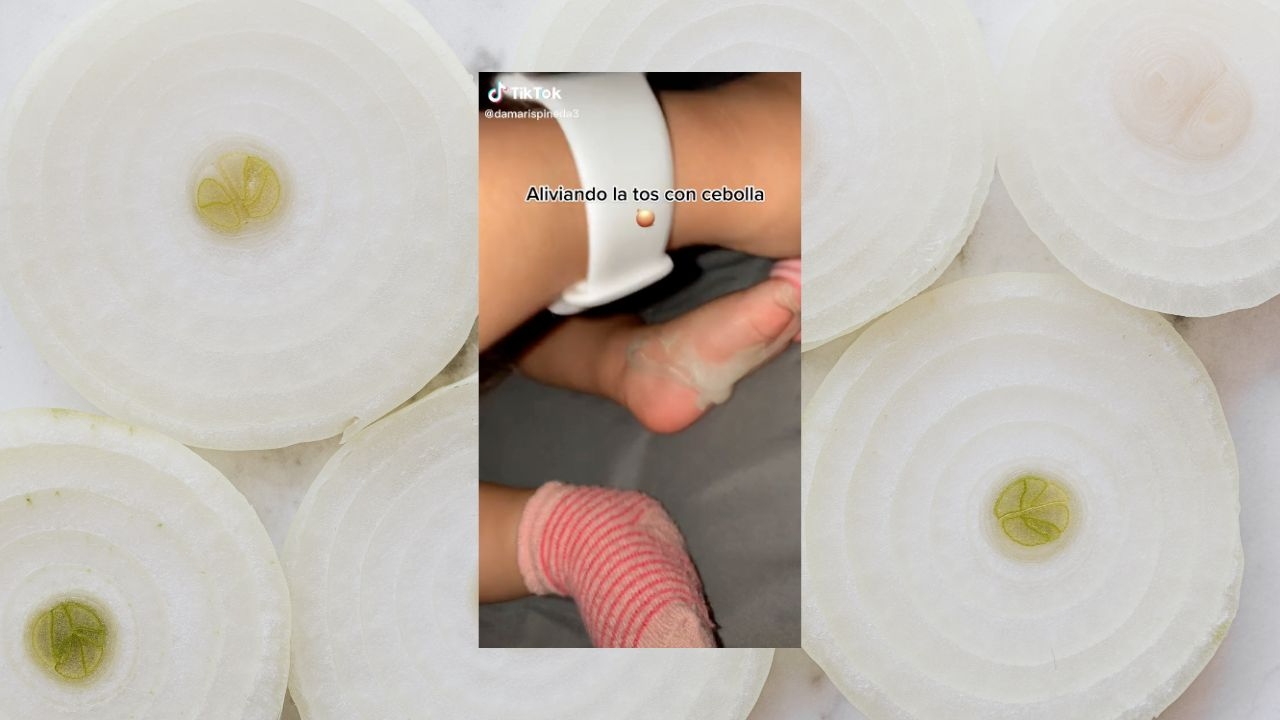 remedio con cebolla tos