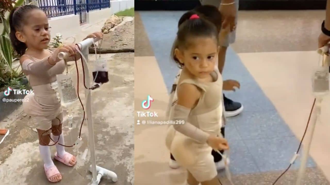 nina disfrazada de mujer operada