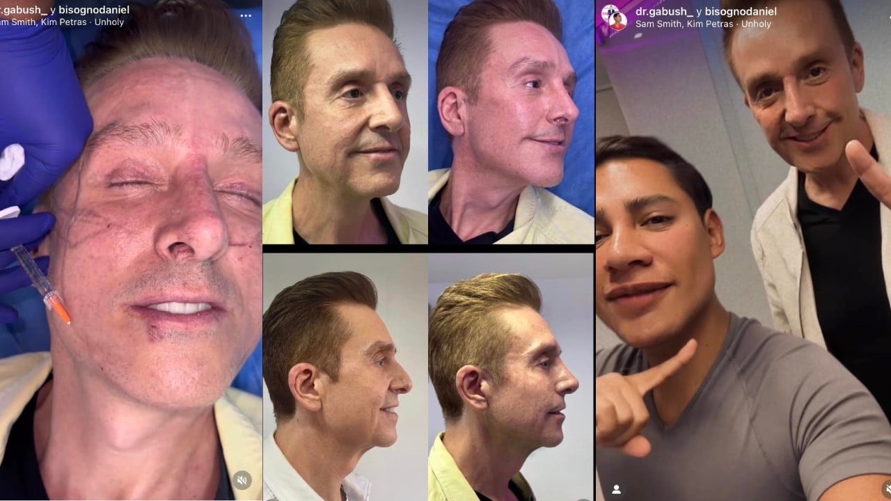 Qué son los hilos tensores de Daniel Bisogno