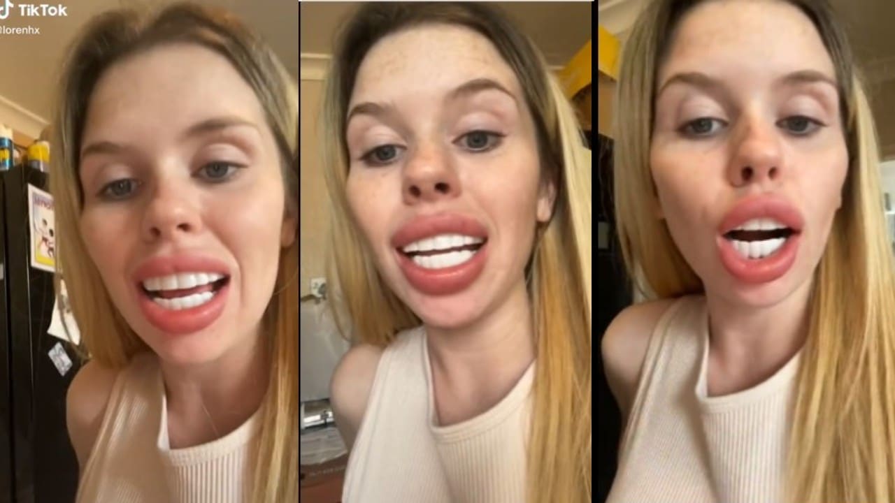 Chica paga por carillas y llora por el resultado