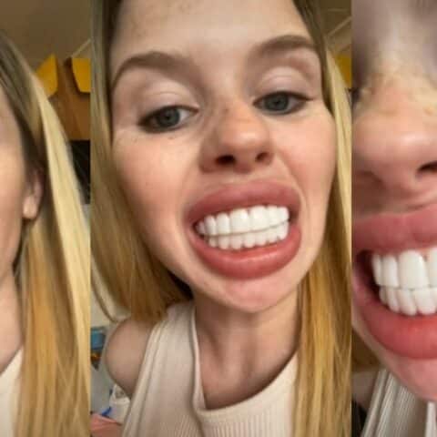 Chica paga por carillas y llora por el resultado