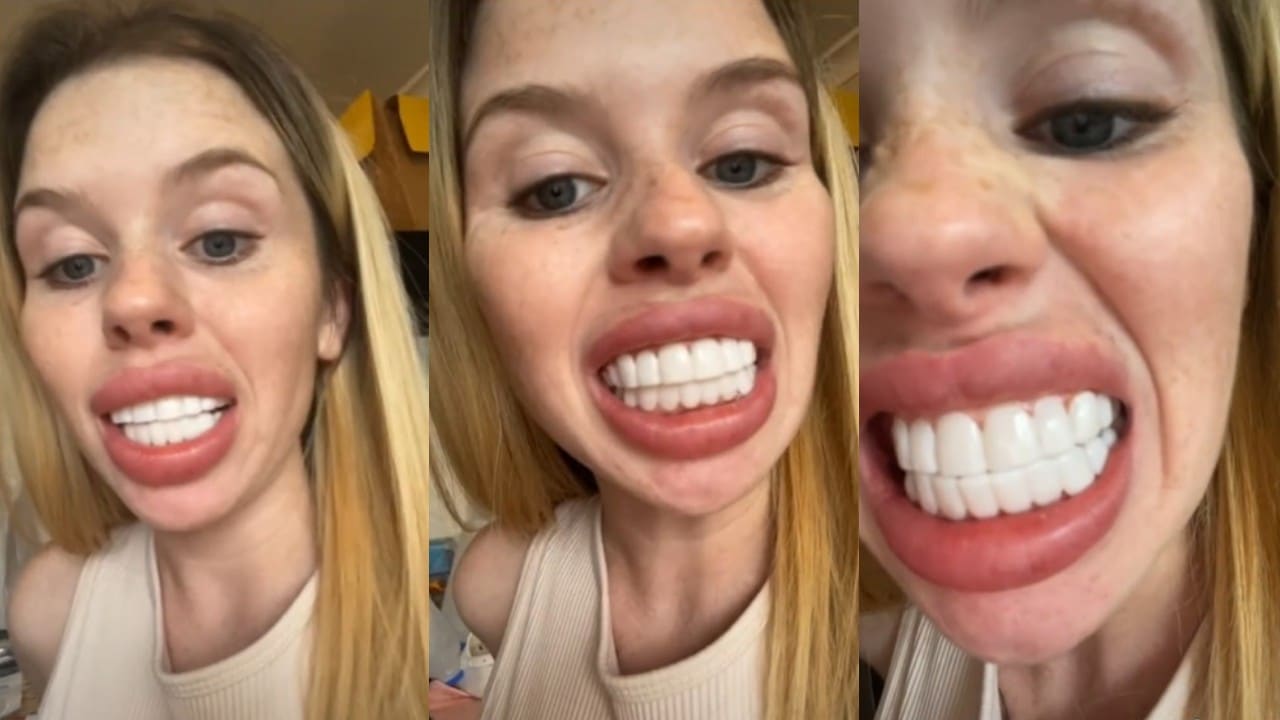 Chica paga por carillas y llora por el resultado