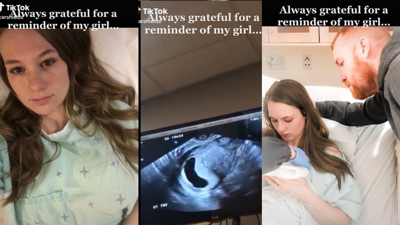 madres que perdieron un bebé