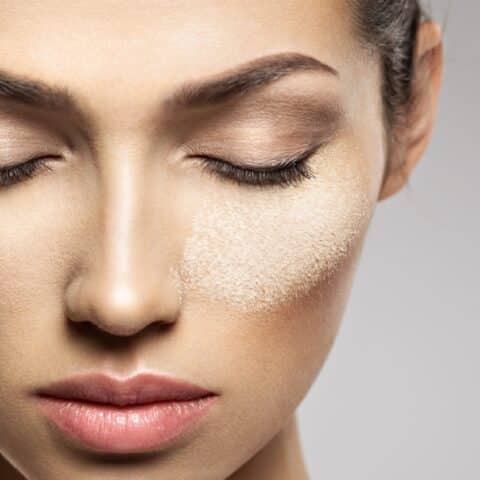 piel pasa por una deficiencia de vitaminas