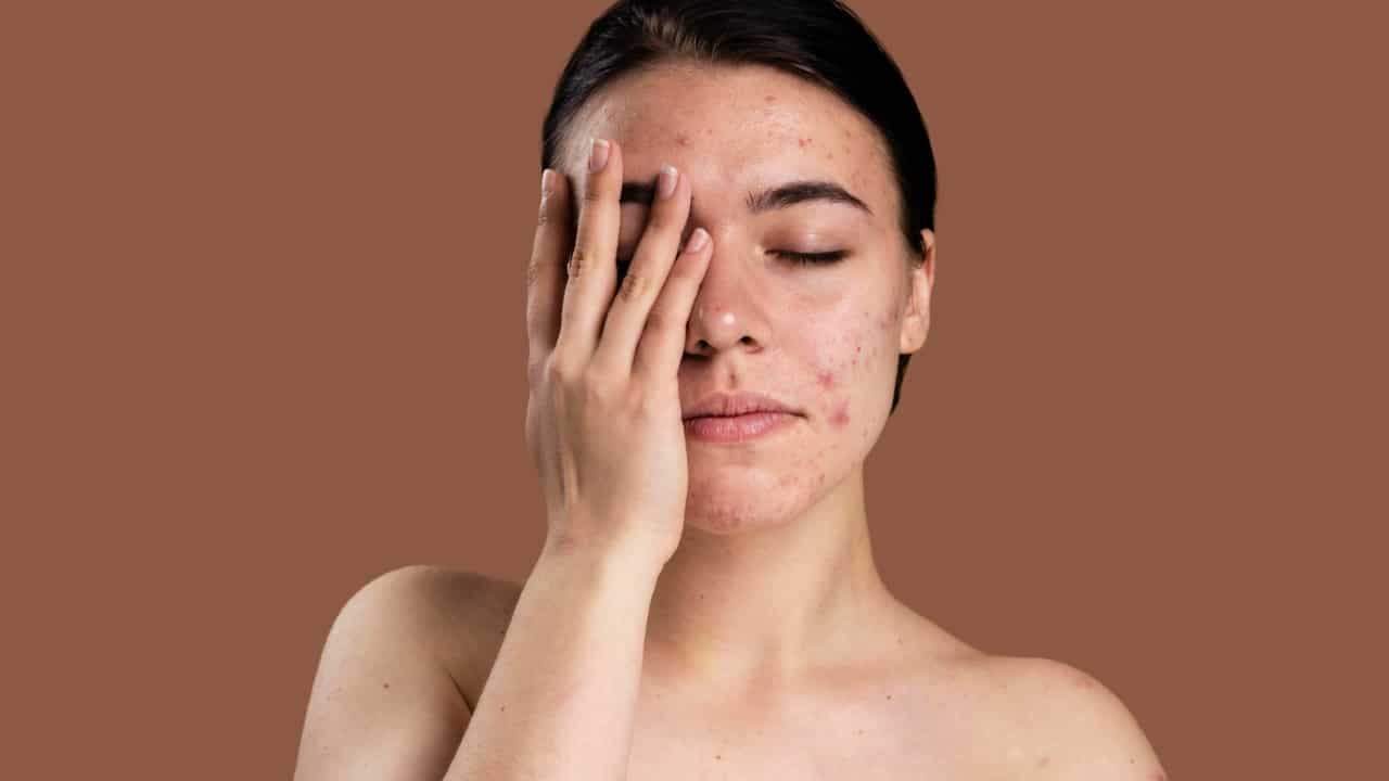 falta de vitaminas en la piel