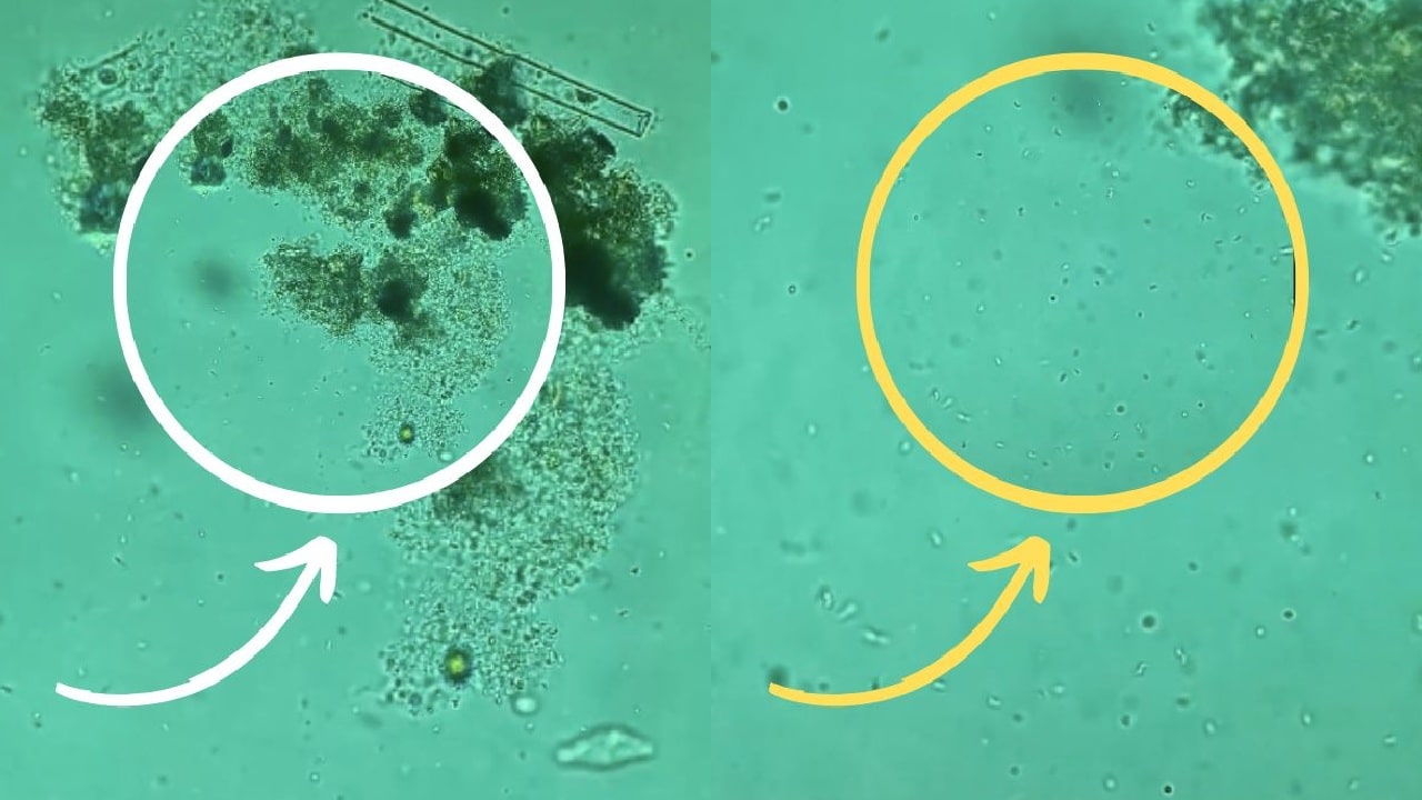 bacterias en esponjas de cocina