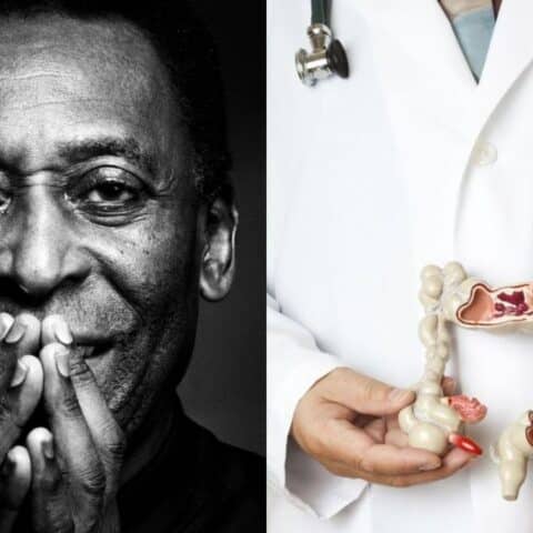 sintomas cancer de colon