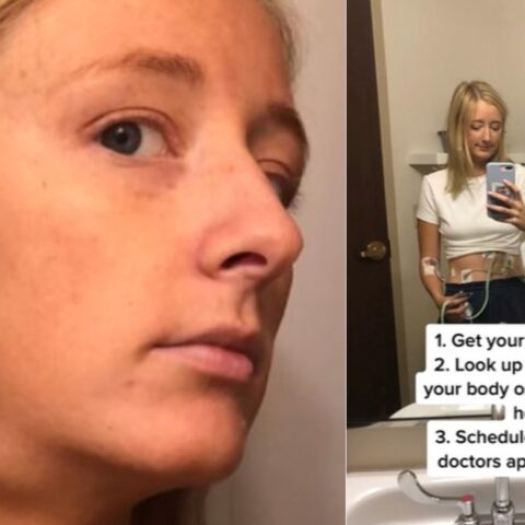 Descubrió que tenía cáncer gracias a truco de belleza