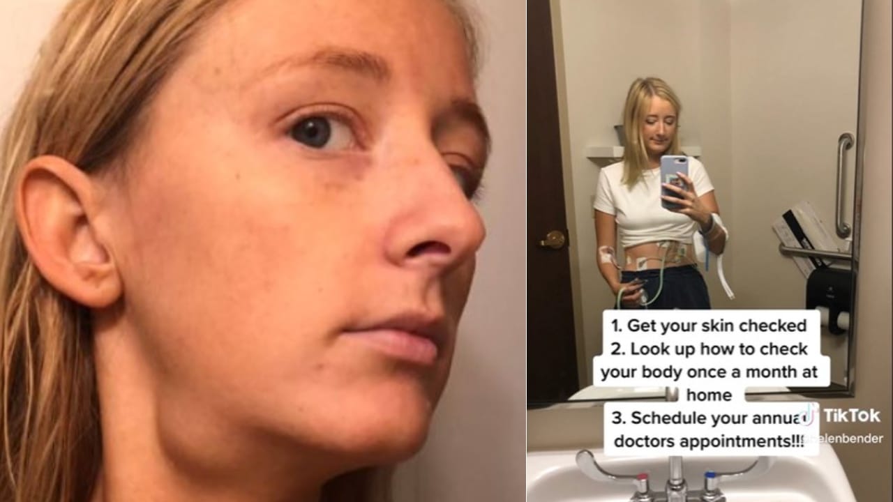 Descubrió que tenía cáncer gracias a truco de belleza