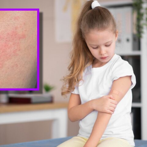 enfermedades que aparecen en los niños por falta de higiene