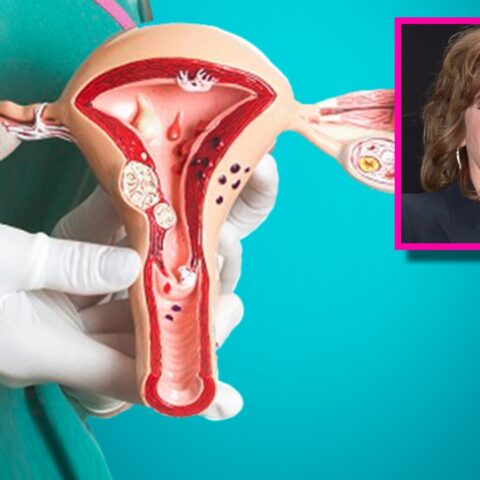 Síntomas de cáncer de ovario