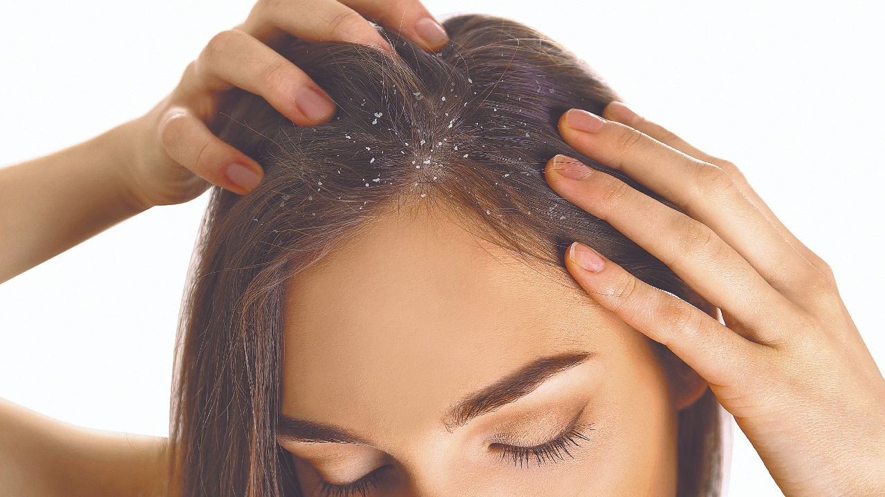 Elimina caspa del cabello