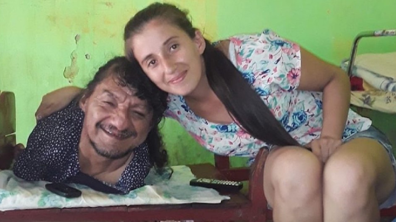 Cuidados de sus hijas sin brazos y piernas