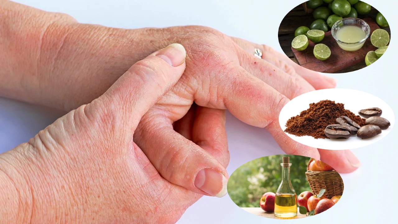 Desvancer manchas de la piel de las manos