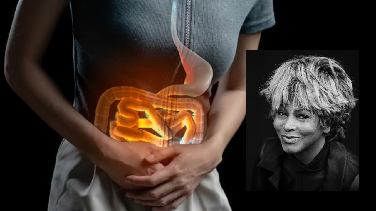 señales tempranas de cáncer intestinal