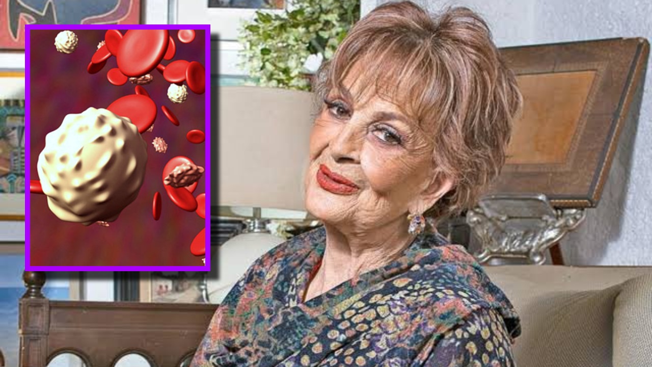 Síntomas de leucemia