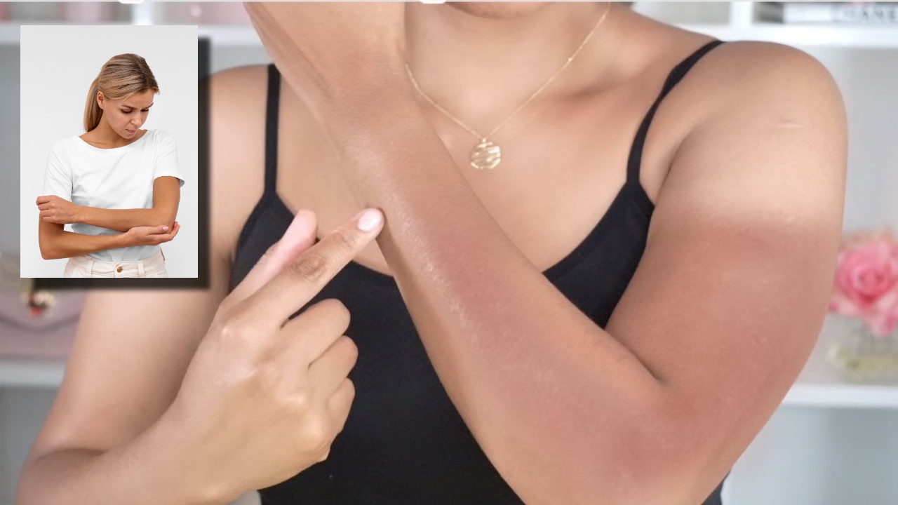 desmanchar los brazos quemados por el sol