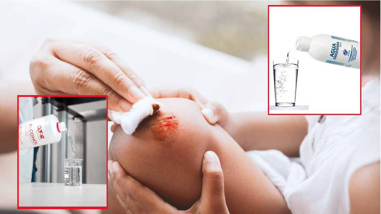 Porque no limpiar heridas con agua oxigenada o alcohol