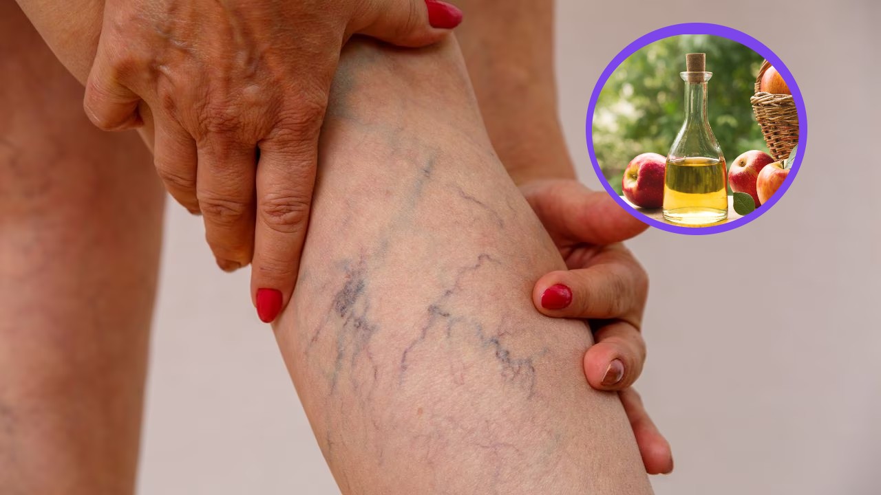 Cómo funciona el remedio natural con vinagre para mejorar la circulación