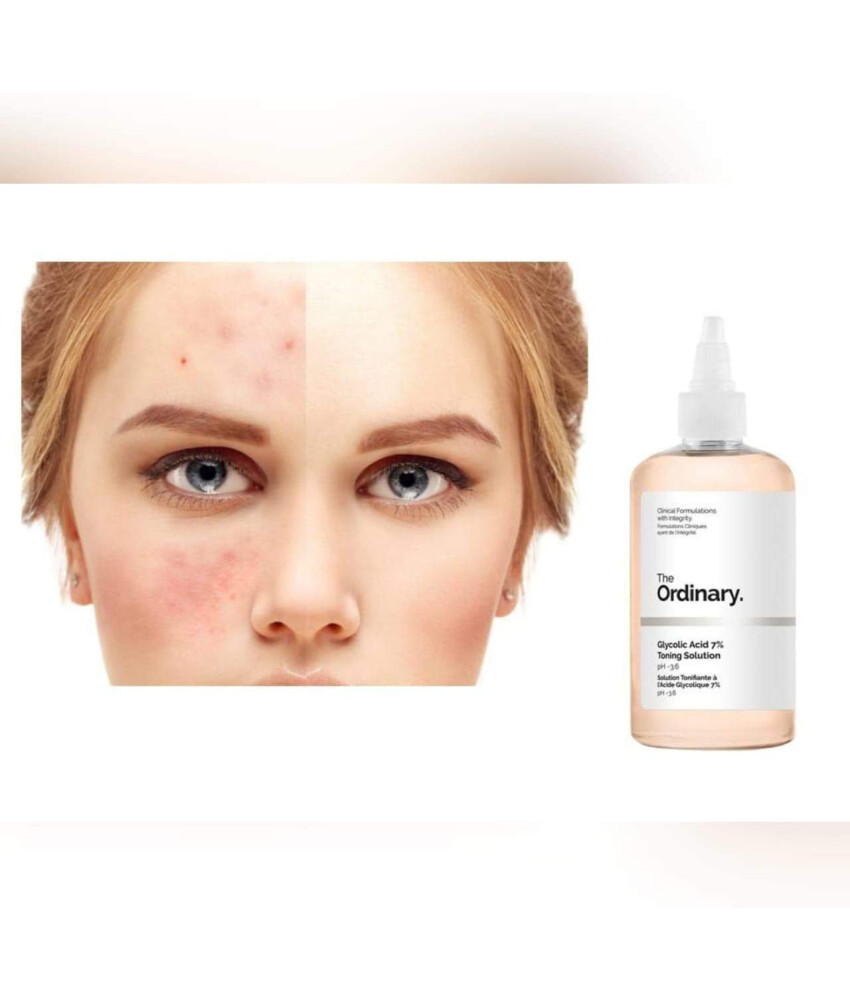 ácido glicólico de The Ordinary que está arrasando