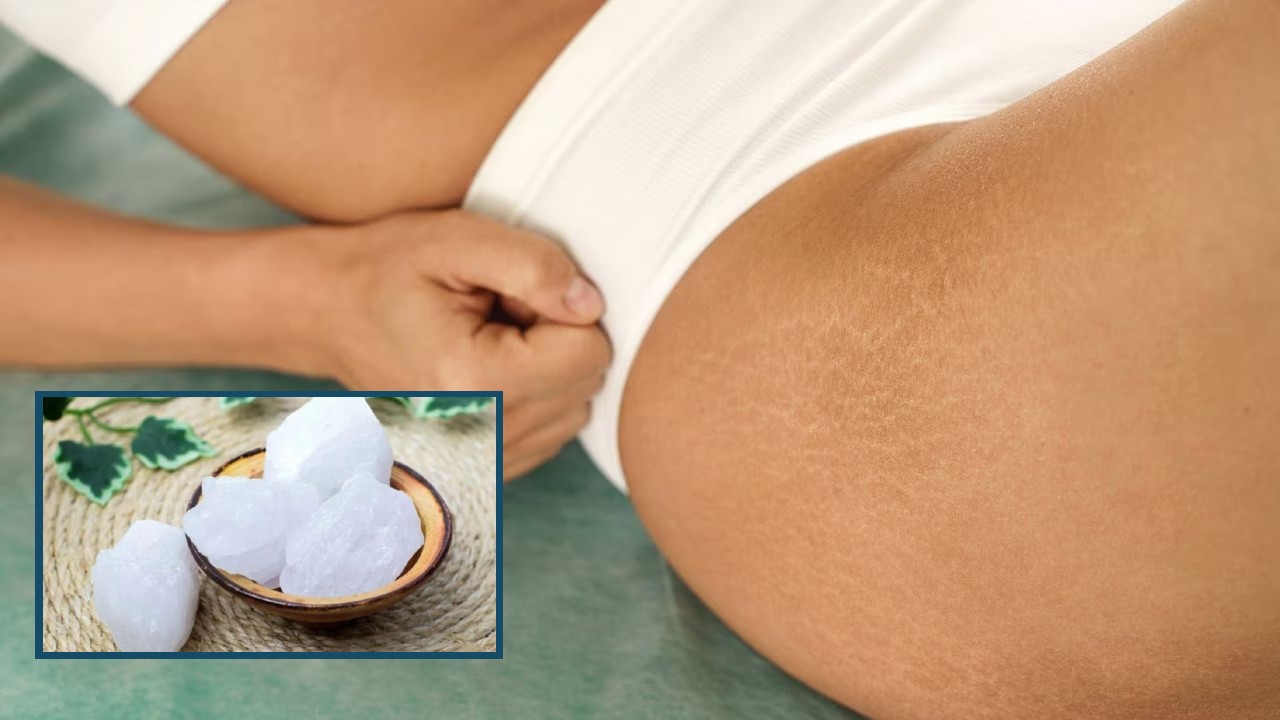 Uso de la piedra de alumbre para las estrías