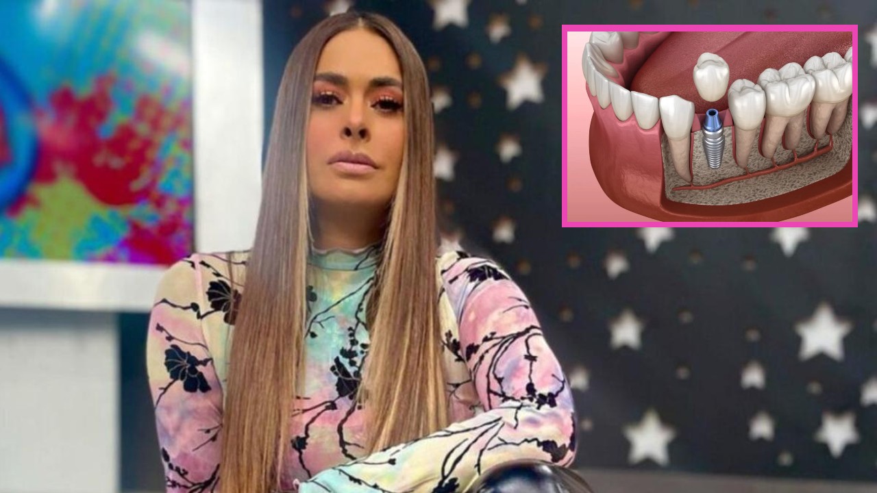 Galilea Montijo injerto óseo dental